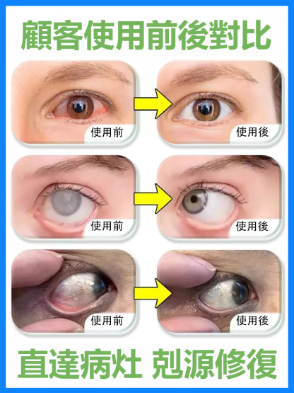 貞大夫醫用眼睛退燒凝膠
