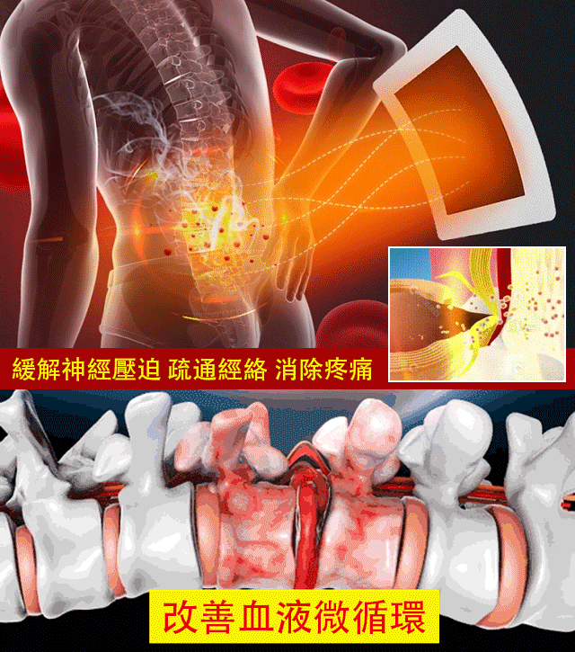 萬物通遠紅外治療貼