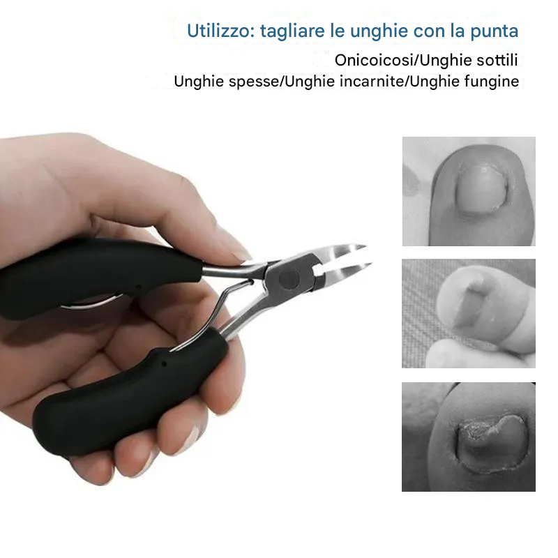 Set tagliaunghie in acciaio inossidabile 304, prevenzione della paronichia, infezione fungina