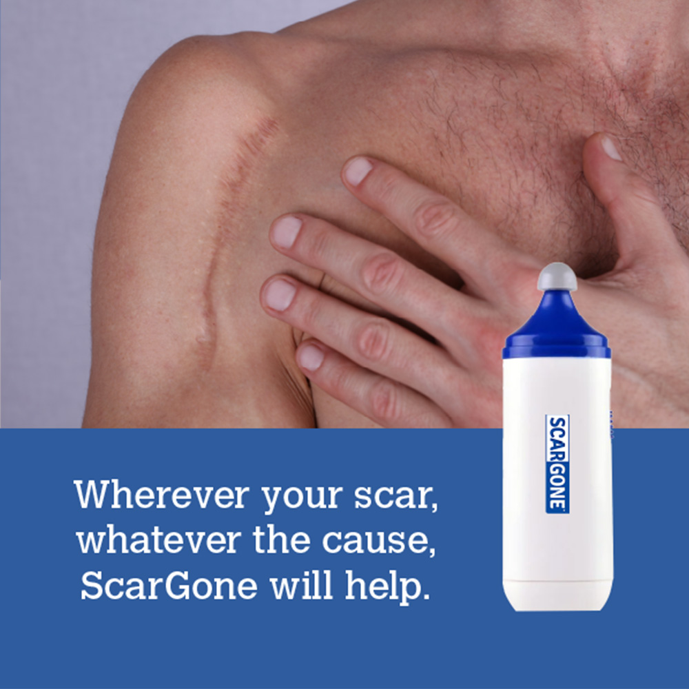 ScarGone Scar Management Massager 