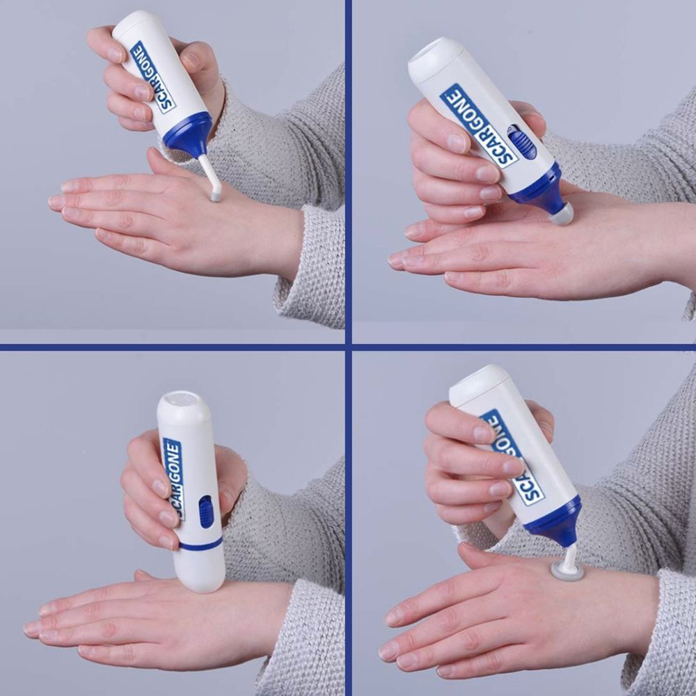 ScarGone Scar Management Massager 