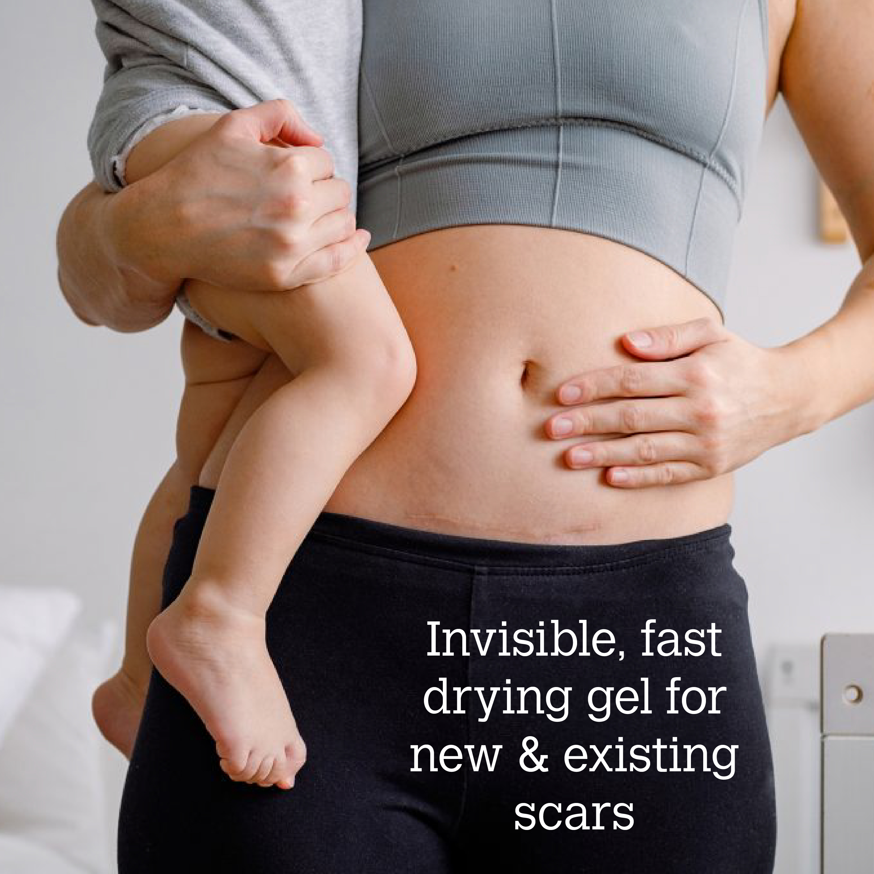 ScarGone Silicone Scar Gel