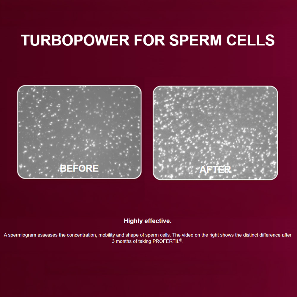 PROfertil Male Fertility Supplement