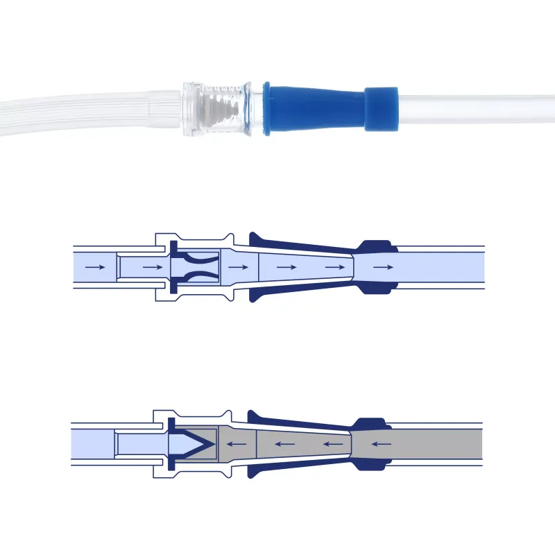 Reprop Clyster Accessories Kit — Enema Replacement Tubes & Valve