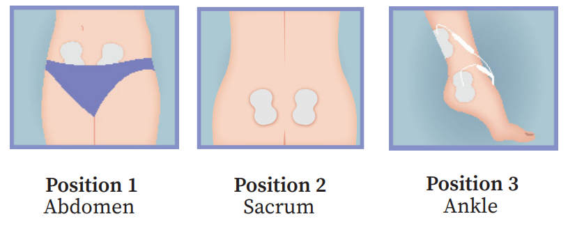 Where to Place Tens Pads for Pelvic Floor: Expert Tips
