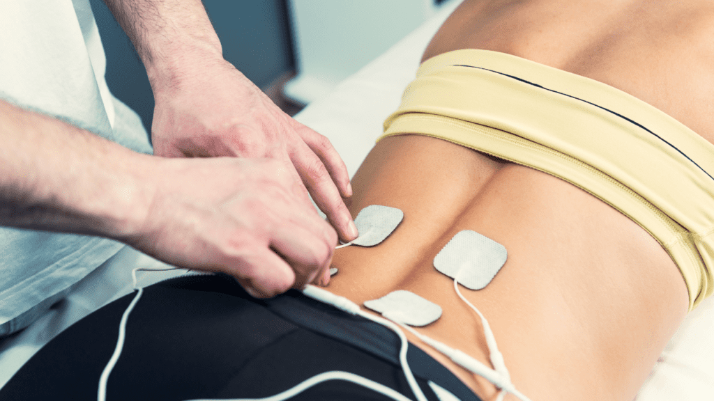 Sacral Nerve Stimulation