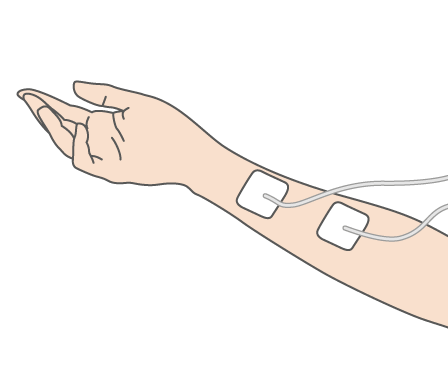 Kegel8 Water Test - Electrodes on Forearm