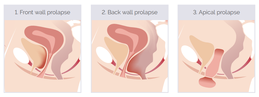 Mushuk mushtlash porno video