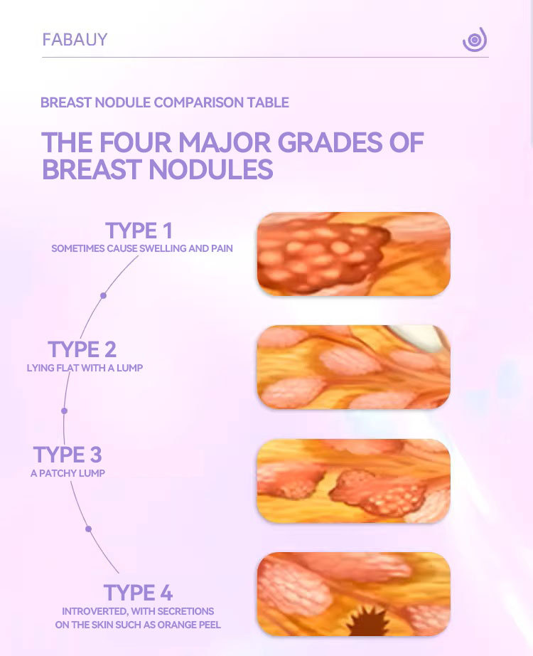 BREAST NODULECONDITIONING CAPSULES