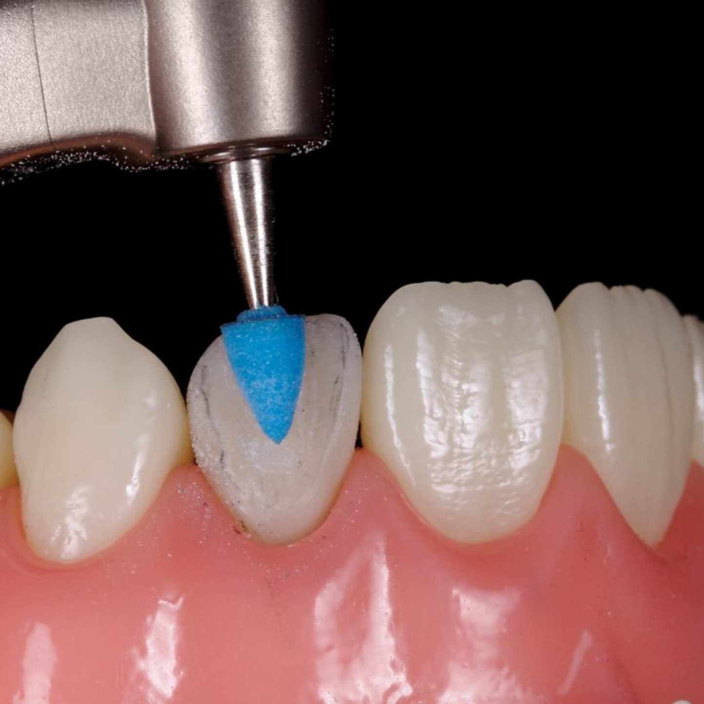 Flexipoints+ - Pack of 6