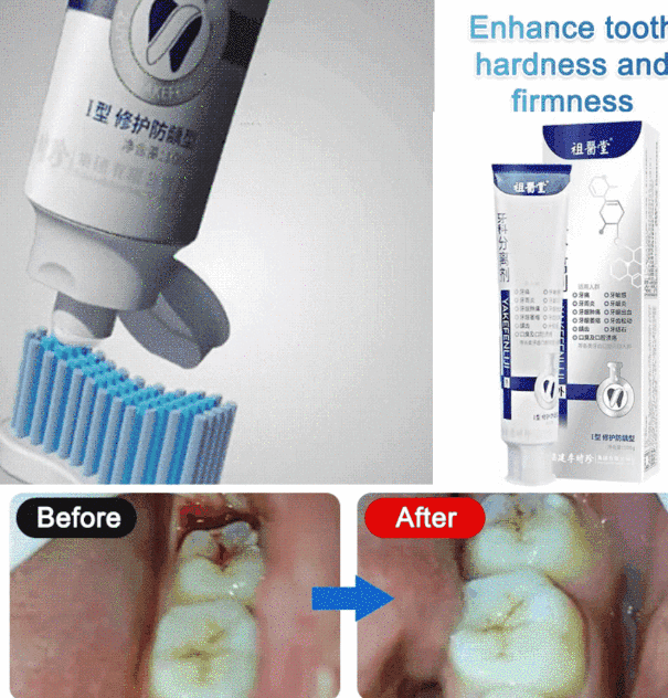 Reparación de dientes, recesión de encías, pasta de dientes desensibilizante, manchas dentales, antibacteriano, sangrado, cálculos, dientes flojos.