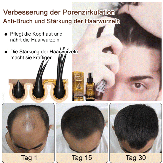 Biotin-Haarwachstumsspray