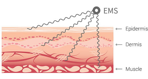 EMS Bioelectric Therapy Acupoint Massaging Body Shaping Mat(especially for varicose veins)