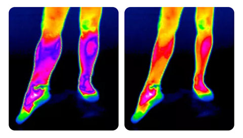 EMS Bioelectric Therapy Acupoint Massaging Body Shaping Mat(especially for varicose veins)