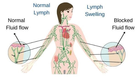 SlimTech EMS LymphDrainage Massager