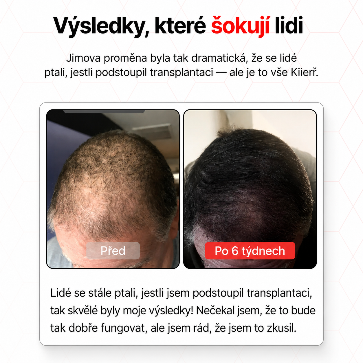[Copy]Marquis drágaköves egymásra rakott gyűrűk