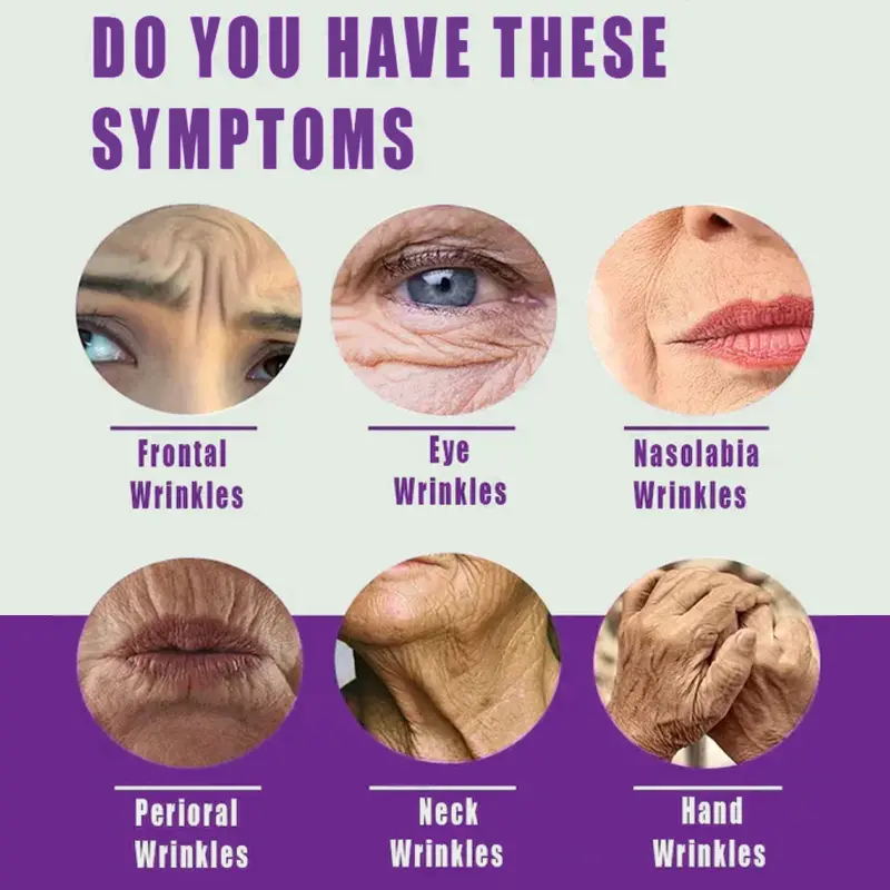 2025 Hot-selling Item A3