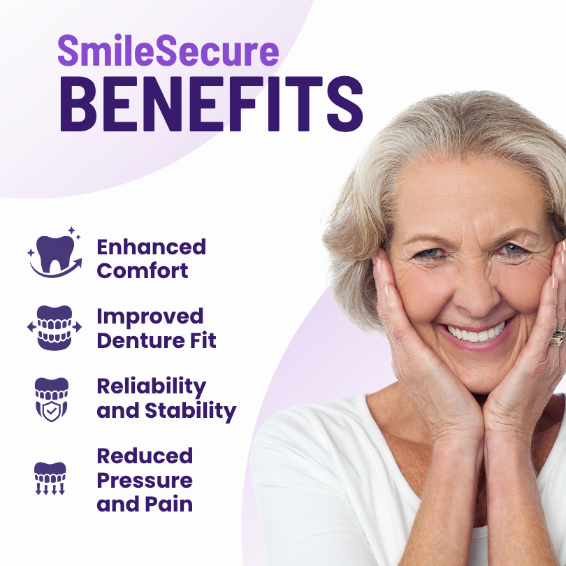 SmileSecure Thermoplastic Denture Adhesive