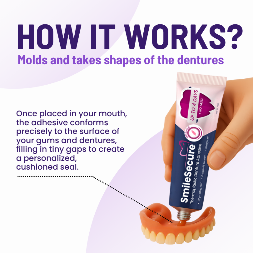 SmileSecure Thermoplastic Denture Adhesive