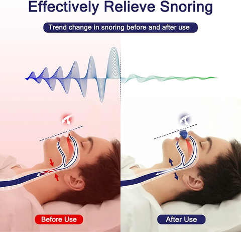 CPAP Sleep Apnea Machine