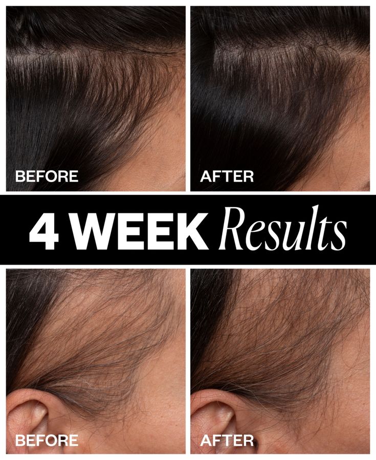 轮播广告图片 0