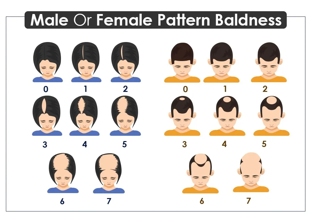 How to Regrow Hairline: The Best Strategies for Growth