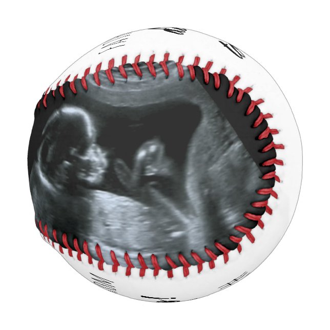 Sonogram Pregnancy Photo Daddy to Be Baseball