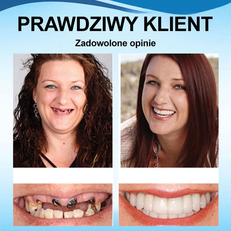 Idealny zestaw protez do perfekcyjnego uśmiechu