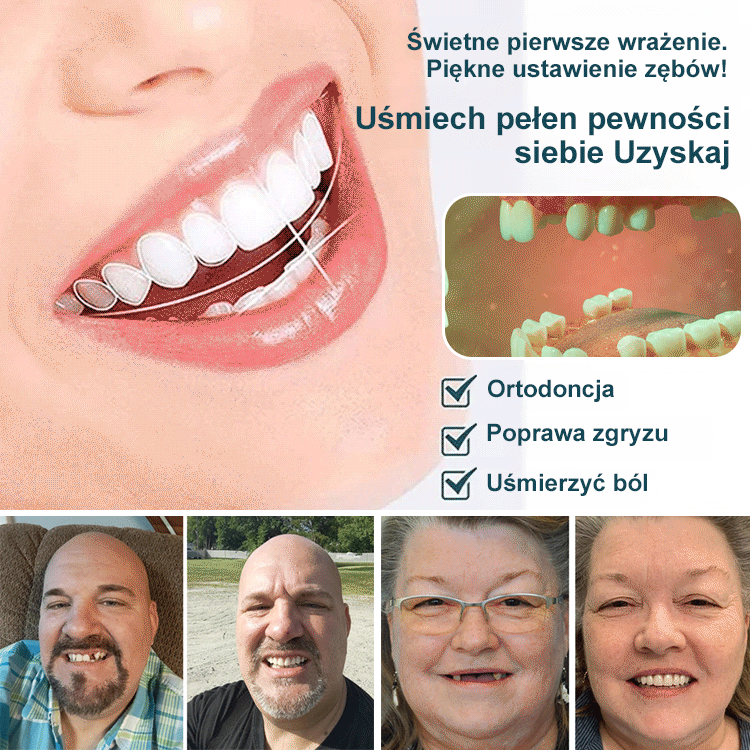 Idealny zestaw protez do perfekcyjnego uśmiechu