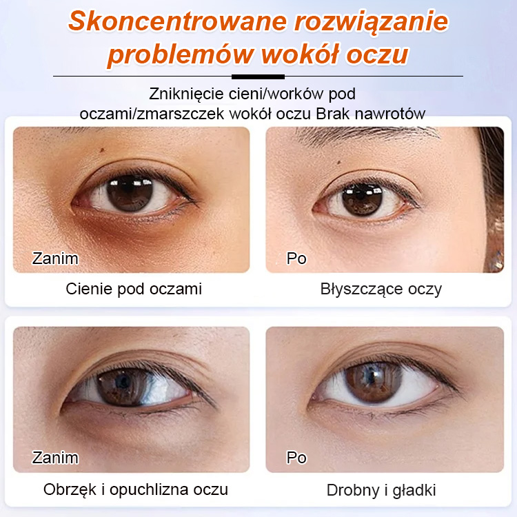 Serum olejowe na zmarszczki i drobne linie wokół oczu. 🌟 Cofnij czas i rozjaśnij okolice oczu! 🌟