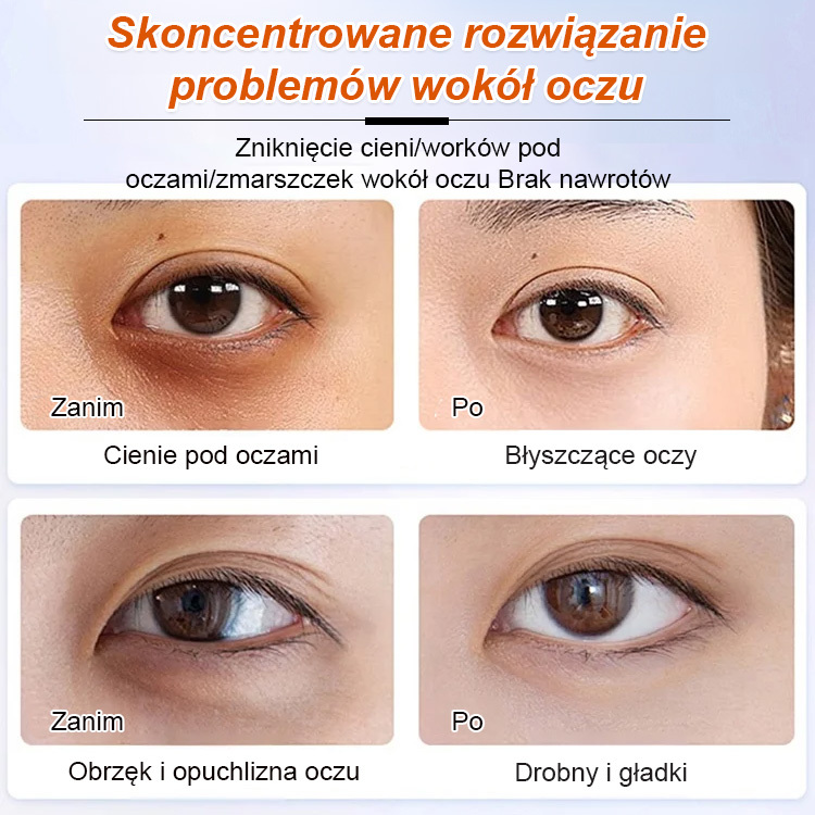 Serum olejowe na zmarszczki i drobne linie wokół oczu. 🌟 Cofnij czas i rozjaśnij okolice oczu! 🌟