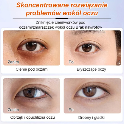 Serum olejowe na zmarszczki i drobne linie wokół oczu. 🌟 Cofnij czas i rozjaśnij okolice oczu! 🌟