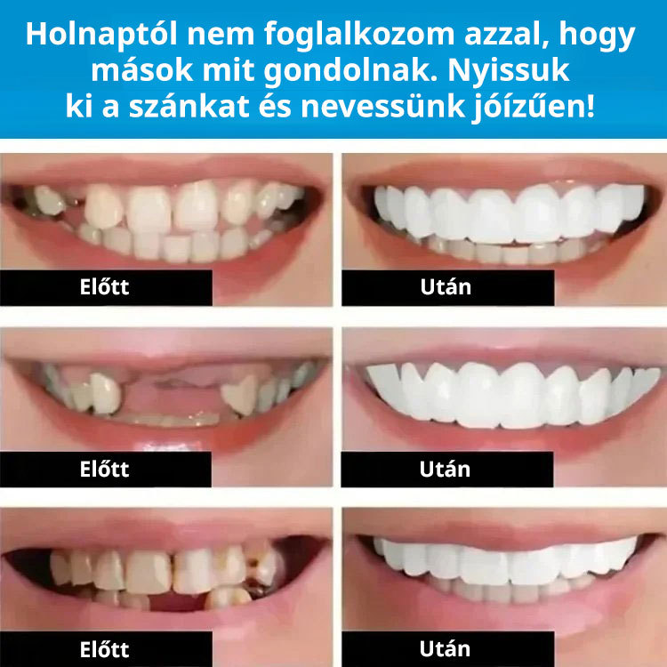 Idealny zestaw protez do perfekcyjnego uśmiechu