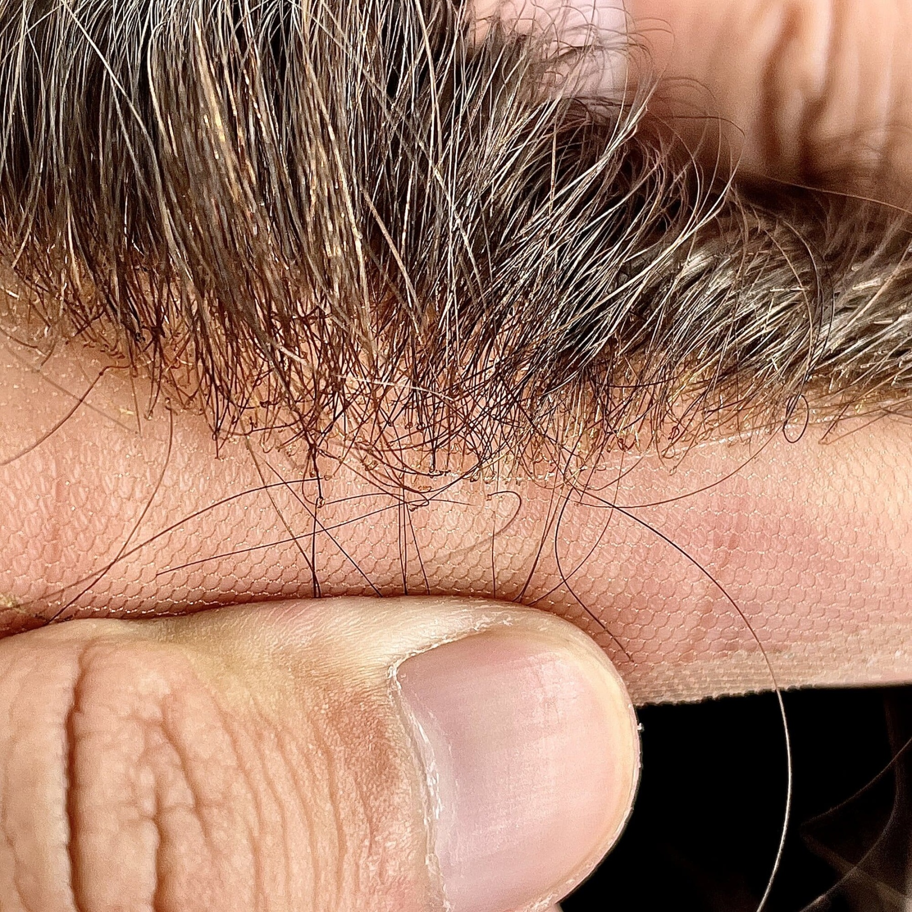 Wholesale Men Toupee In Stock #2 | Q6 Style Hair System  | Guloor Hair