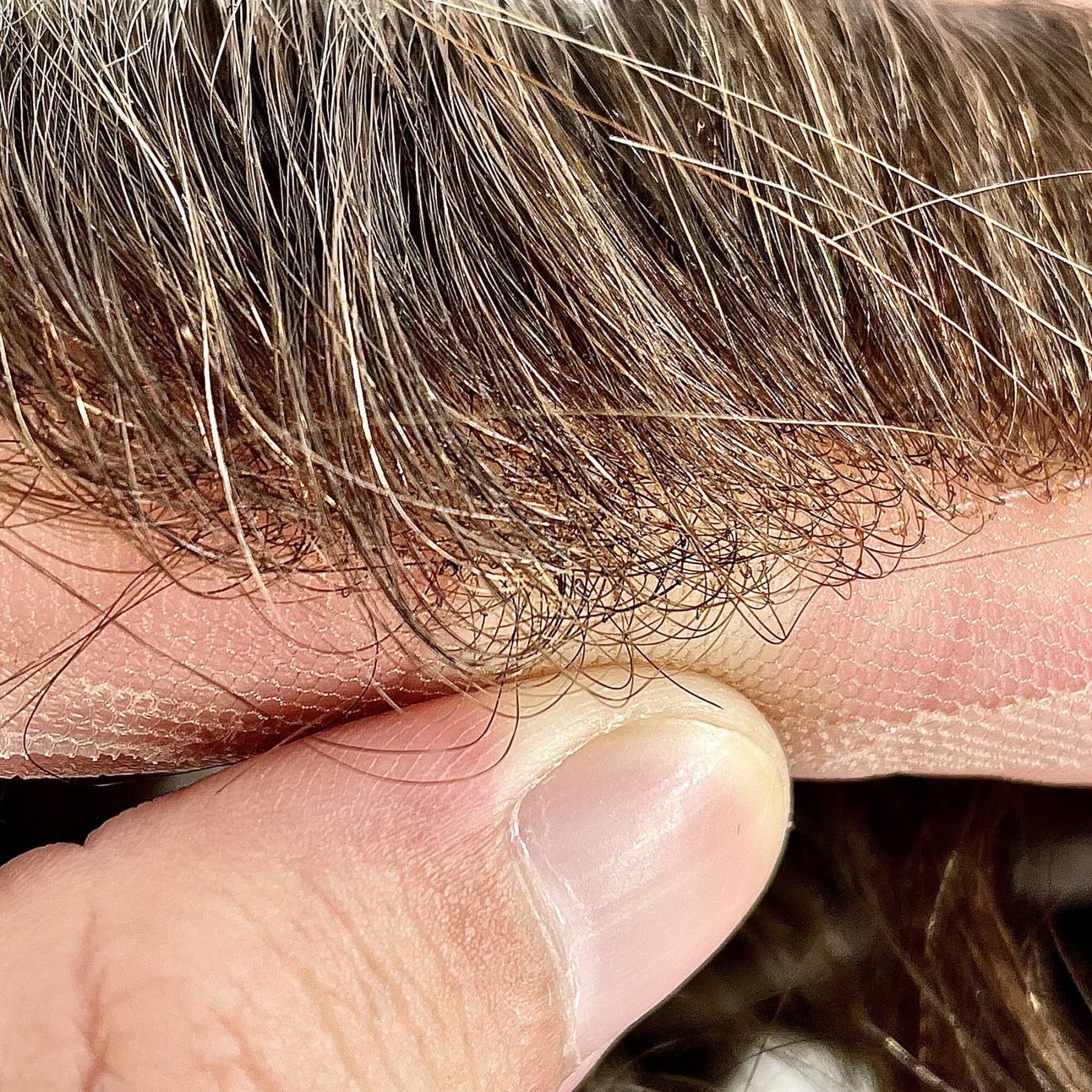 Full Skin Injection With Front Lace Men Toupee Straight 100% Natural Smooth Remy Indian Human Hair Replacement System