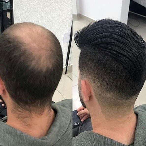 Qingdao Factory Supplier Pu Around Lace Base Men Toupee In Stock