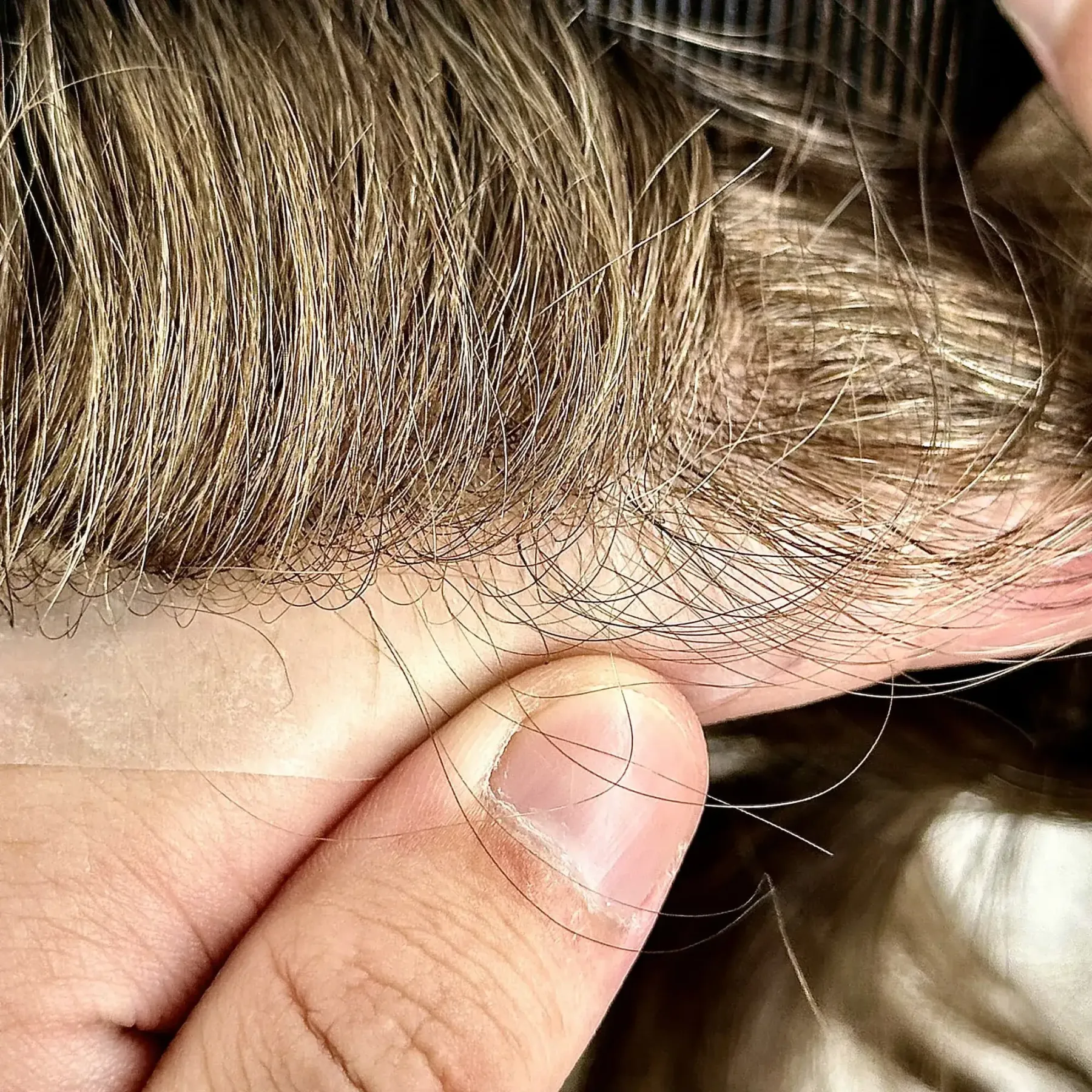 SKIN-Custom Order Human Hair Skin V-loop #22 Men toupee