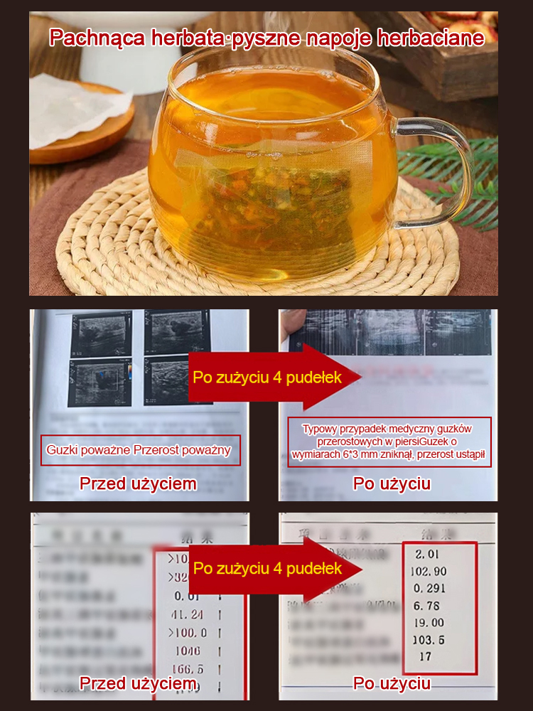 Herbata z kłączem trędownika, mniszkiem lekarskim, lilią i porią.