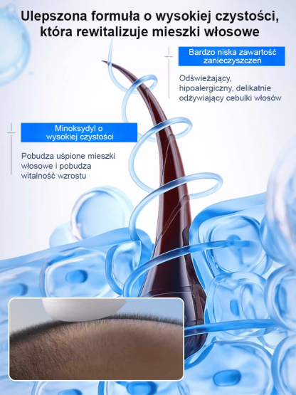 5% najlepiej skoncentrowana pianka minoksydylowa, efekty widoczne w ciągu tygodnia, odzyskaj swoje piękne włosy! 🌟💁‍♂️💁‍♀️