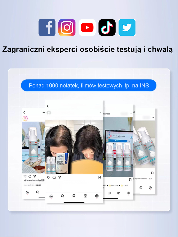 5% najlepiej skoncentrowana pianka minoksydylowa, efekty widoczne w ciągu tygodnia, odzyskaj swoje piękne włosy! 🌟💁‍♂️💁‍♀️