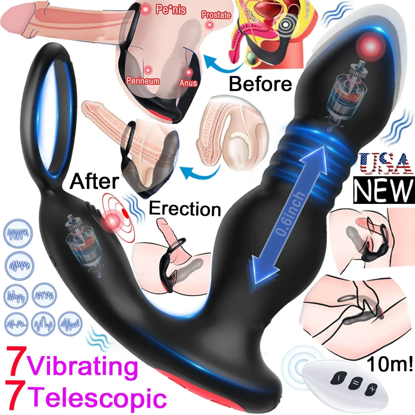 💥Special launch in 2024-💥BEISAR prostate massager