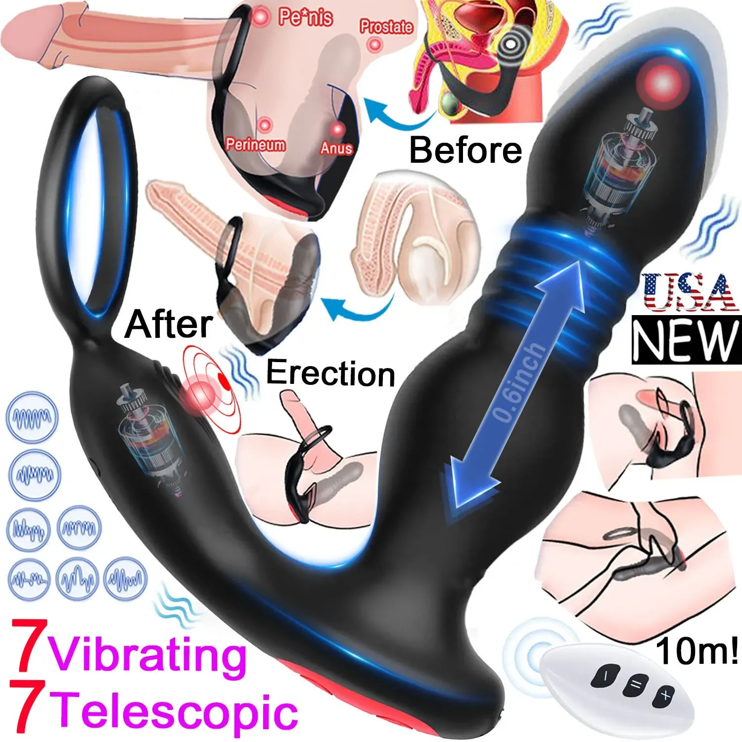 💥Special launch in 2024-💥BEISAR prostate massager