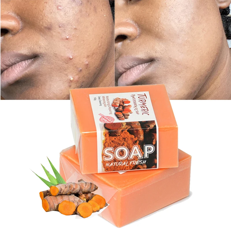 Private Label organic ginger handmade tumeric bar soap bath anti acne dark spots removal whitening turmeric soap