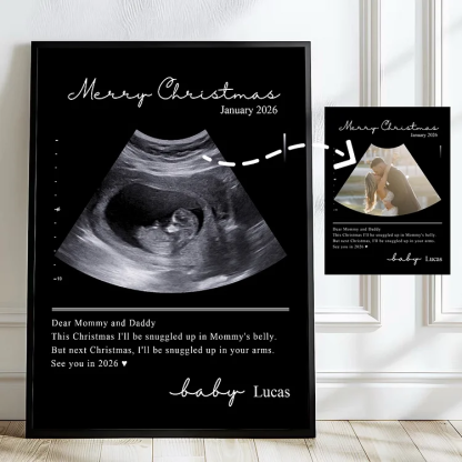 Custom Baby Ultrasound Lenticular Flip Print Gift