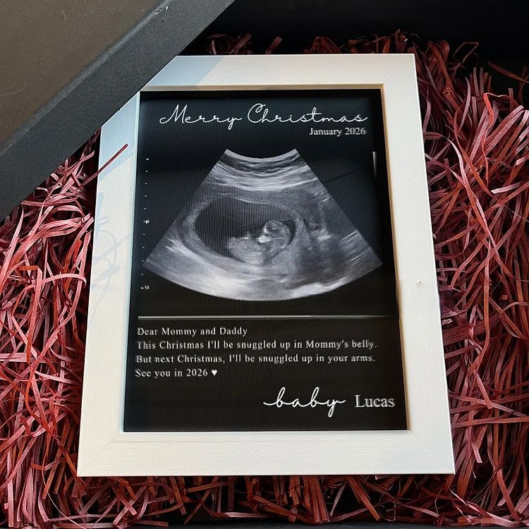 Custom Baby Ultrasound Lenticular Flip Print Gift