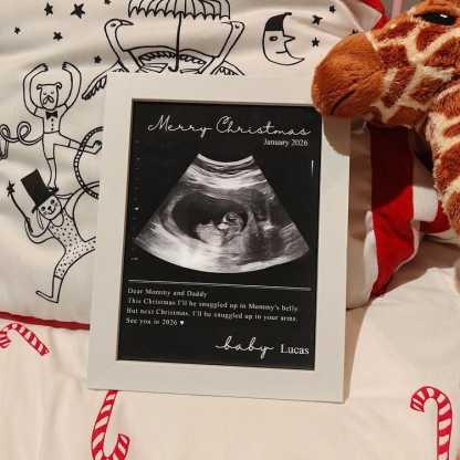 Custom Baby Ultrasound Lenticular Flip Print Gift
