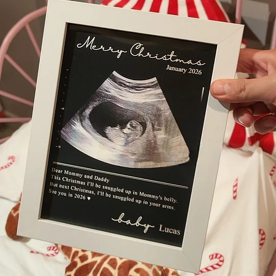 Custom Baby Ultrasound Lenticular Flip Print Gift