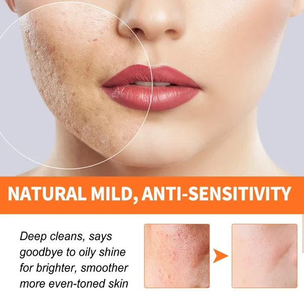 🔥 Hot Sale-49% OFF💥 2023 New Magical Carrot Bubble Mask - BUY 2 GET1 FREE