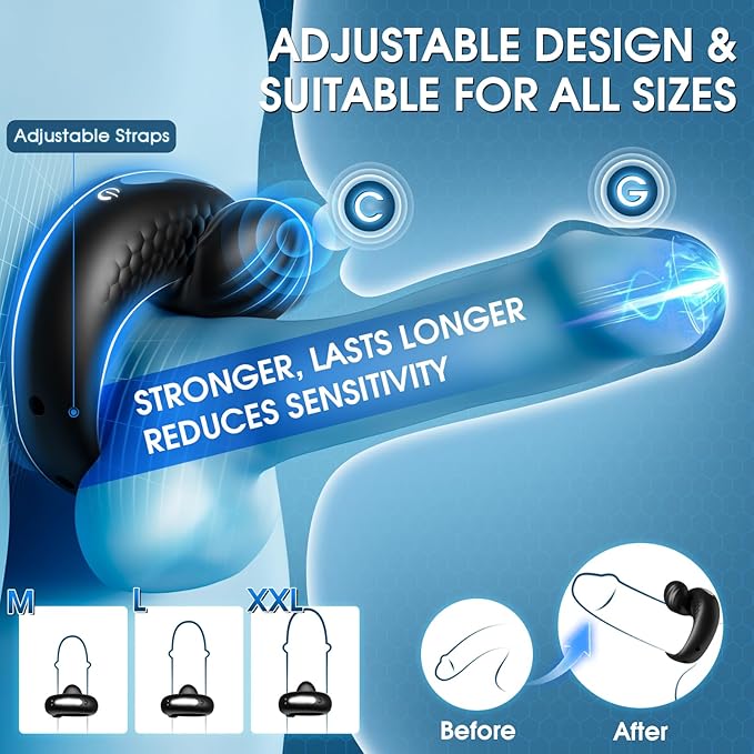 High-energy shockwave therapy - Newman™