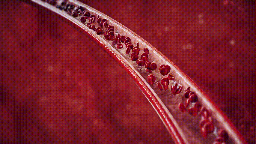 Vascular Hemodynamic Simulation